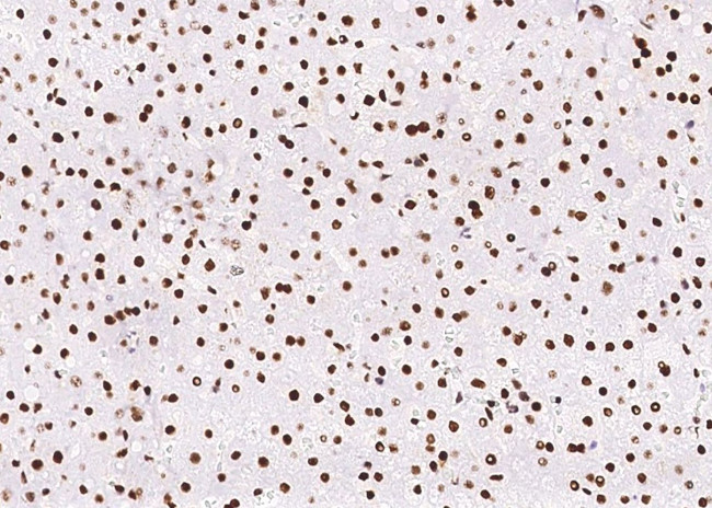 PCNA Antibody in Immunohistochemistry (Paraffin) (IHC (P))