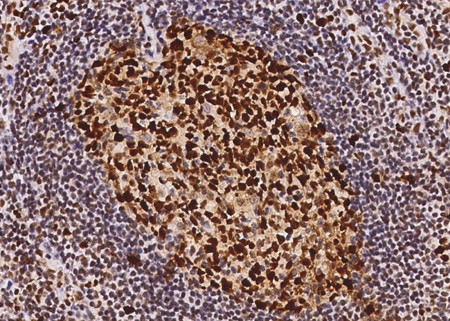 PCNA Antibody in Immunohistochemistry (Paraffin) (IHC (P))