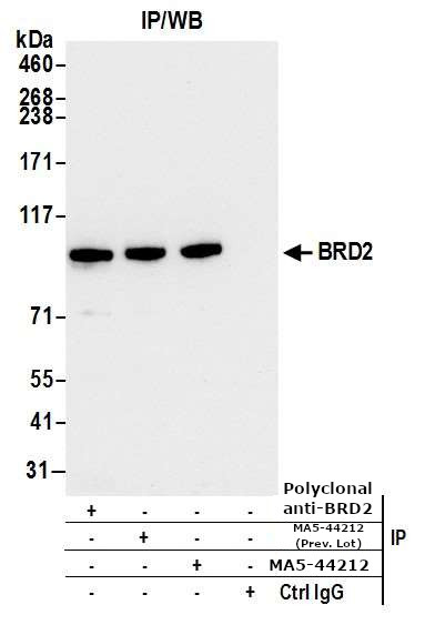 BRD2 Antibody in Immunoprecipitation (IP)