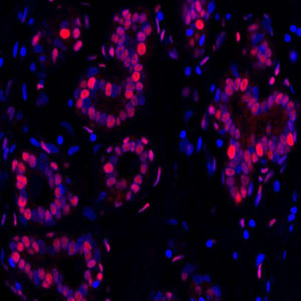 PCNA Antibody in Immunohistochemistry (Paraffin) (IHC (P))