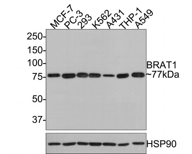 BAAT1 Antibody in Western Blot (WB)