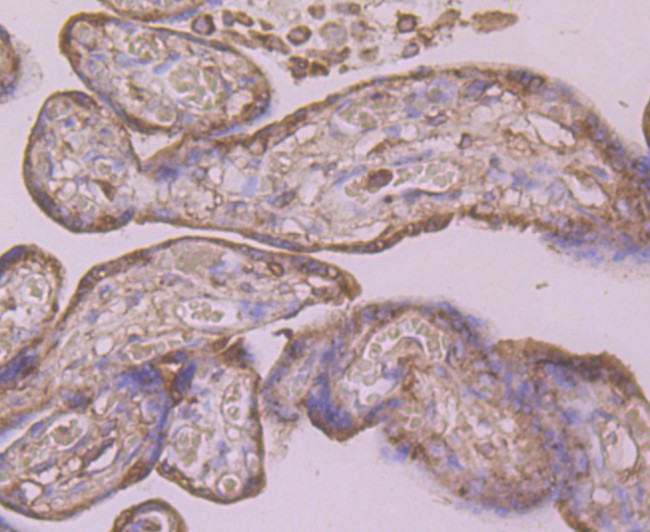 Calreticulin Antibody in Immunohistochemistry (Paraffin) (IHC (P))