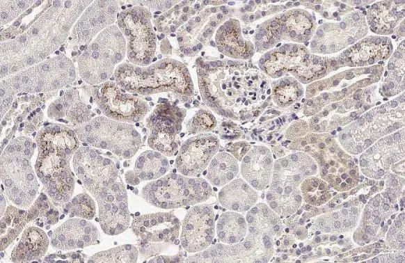 MX1 Antibody in Immunohistochemistry (Paraffin) (IHC (P))