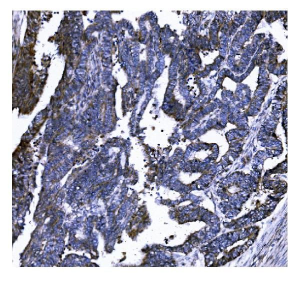 GSDMD Antibody in Immunohistochemistry (Paraffin) (IHC (P))