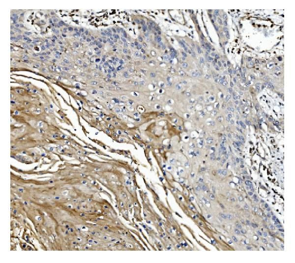 GSDMD Antibody in Immunohistochemistry (Paraffin) (IHC (P))