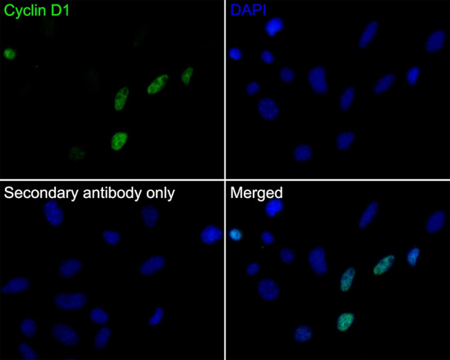 Cyclin D1 Antibody in Immunocytochemistry (ICC/IF)