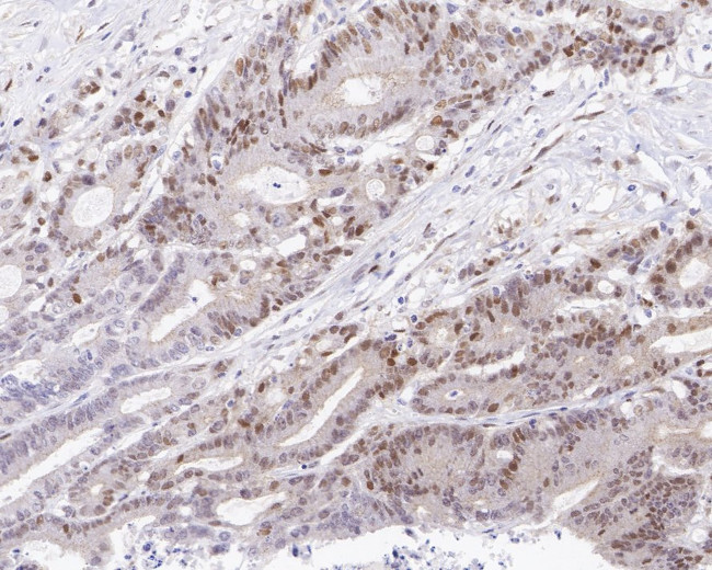 Cyclin D1 Antibody in Immunohistochemistry (Paraffin) (IHC (P))