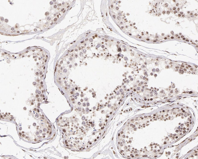 Cyclin D1 Antibody in Immunohistochemistry (Paraffin) (IHC (P))