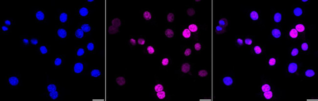 Cyclin D1 Antibody in Immunocytochemistry (ICC/IF)