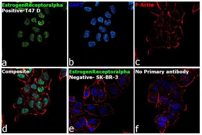 Estrogen Receptor alpha Antibody