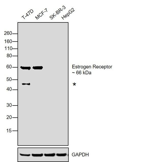 Estrogen Receptor alpha Antibody