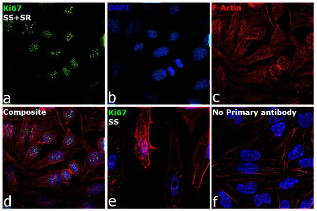 Ki-67 Antibody