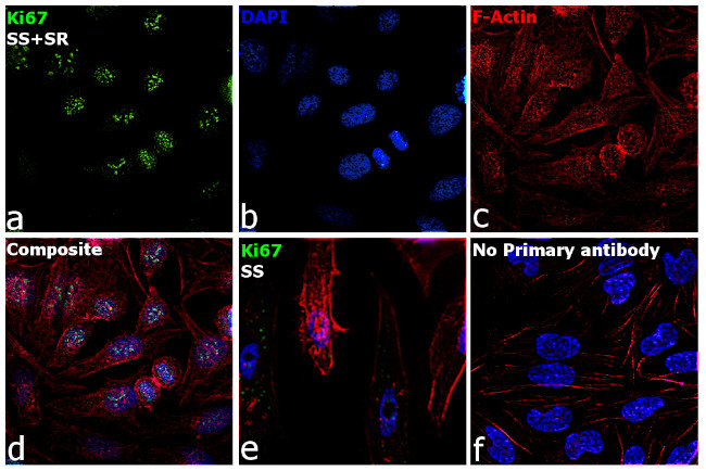 Ki-67 Antibody in Immunocytochemistry (ICC/IF)