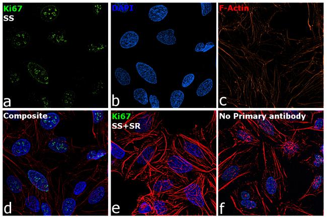 Ki-67 Antibody