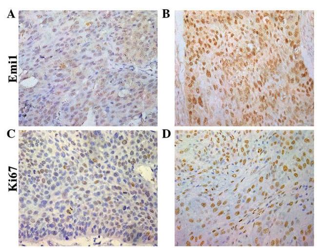 Ki-67 Antibody in Immunohistochemistry (Paraffin) (IHC (P))