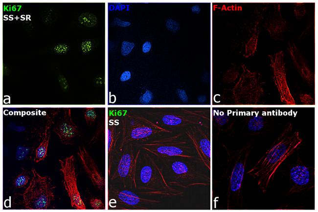 Ki-67 Antibody