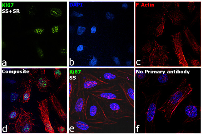 Ki-67 Antibody in Immunocytochemistry (ICC/IF)