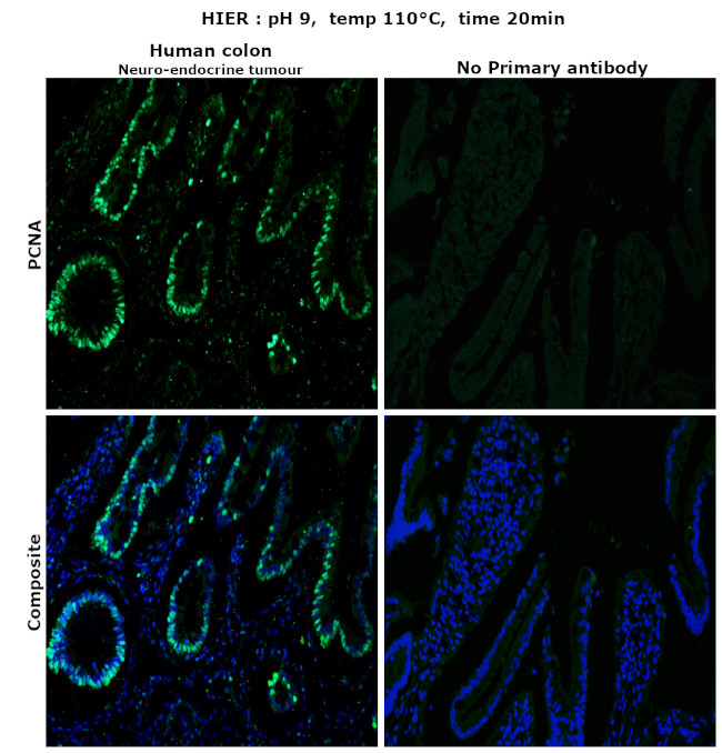 PCNA Antibody in Immunohistochemistry (Paraffin) (IHC (P))