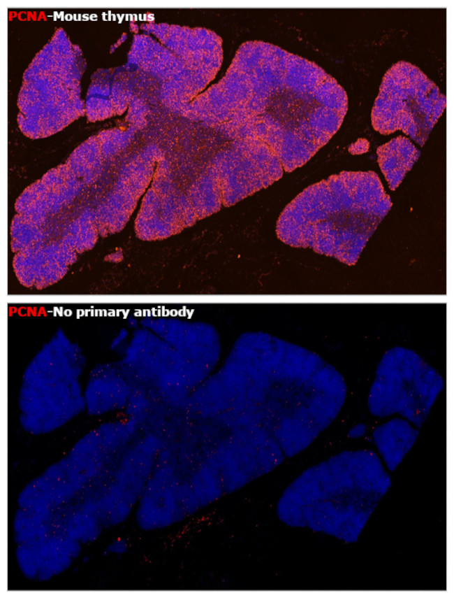 PCNA Antibody in Immunohistochemistry (Paraffin) (IHC (P))