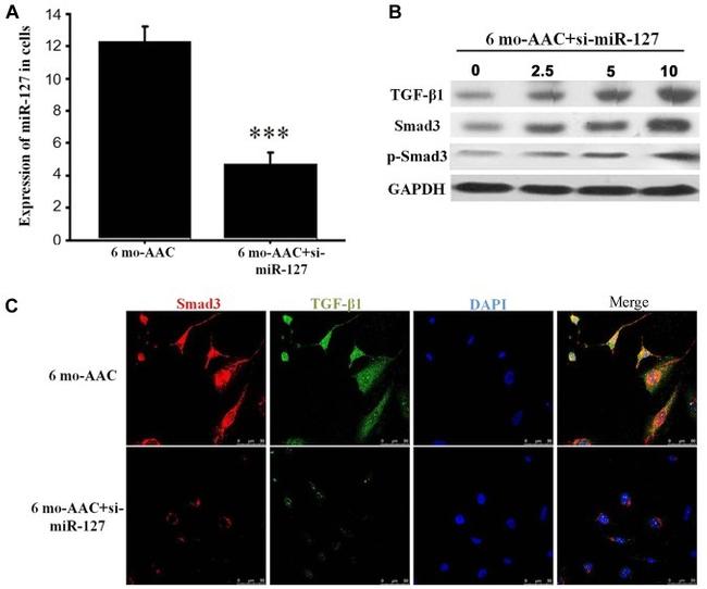 SMAD3 Antibody in Immunocytochemistry (ICC/IF)