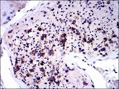 NQO1 Antibody in Immunohistochemistry (Paraffin) (IHC (P))