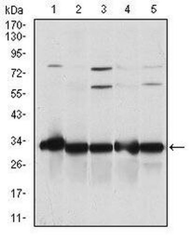 NQO1 Antibody in Western Blot (WB)