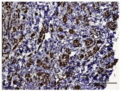 HIF1A Antibody in Immunohistochemistry (Paraffin) (IHC (P))