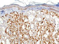 Ki-67 Antibody in Immunohistochemistry (IHC)