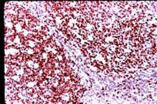 Ki-67 Antibody in Immunohistochemistry (Paraffin) (IHC (P))