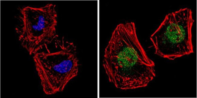 NCoR1 Antibody in Immunocytochemistry (ICC/IF)