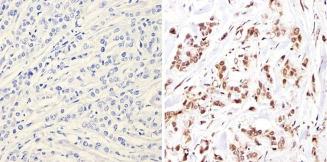 NCoR1 Antibody in Immunohistochemistry (Paraffin) (IHC (P))