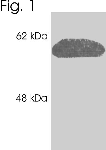 Calreticulin Antibody in Western Blot (WB)