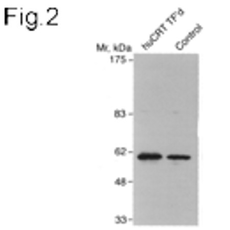 Calreticulin Antibody in Western Blot (WB)