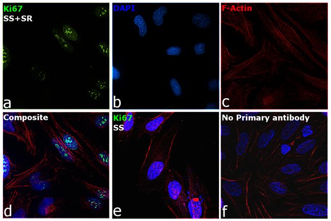 Ki-67 Antibody