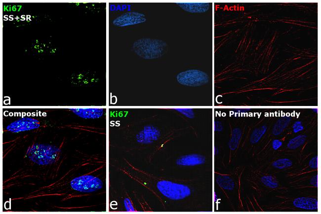 Ki-67 Antibody