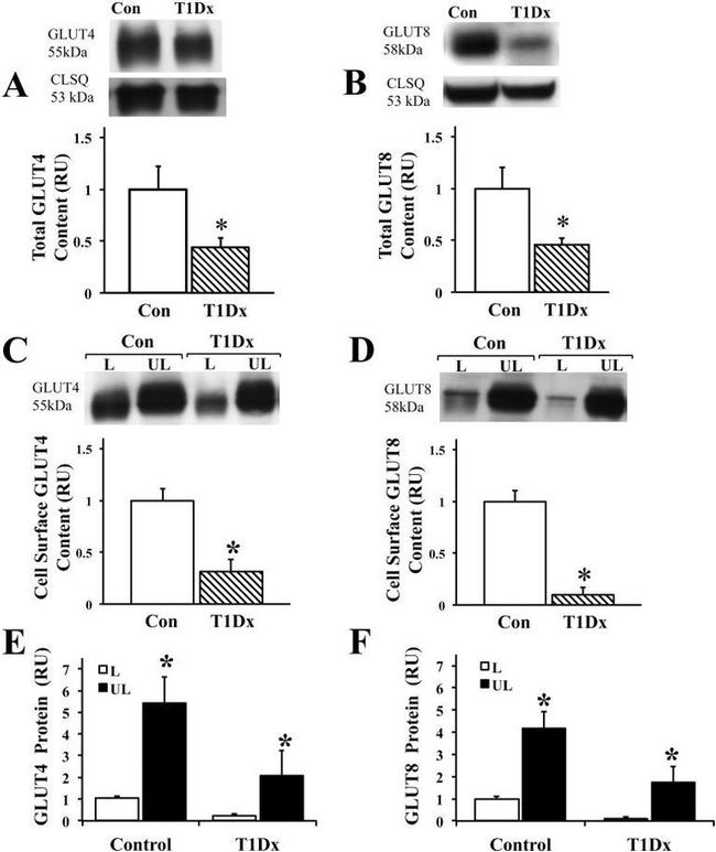 Calreticulin Antibody in Western Blot (WB)