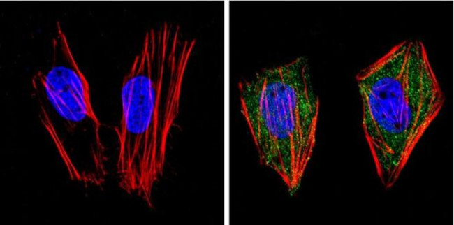 PPAR gamma Antibody in Immunocytochemistry (ICC/IF)