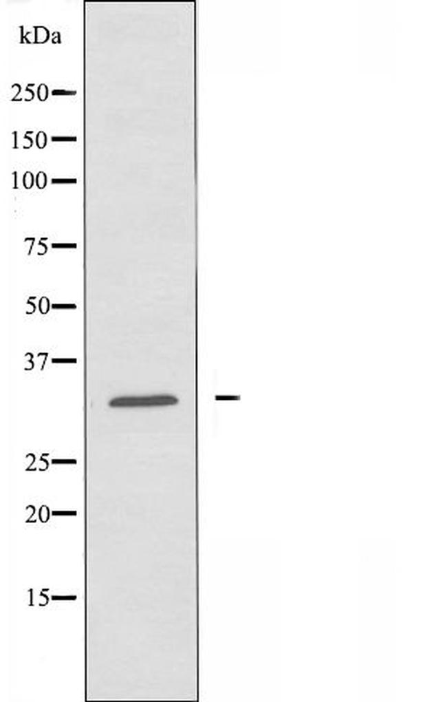 CBR1 Antibody in Western Blot (WB)