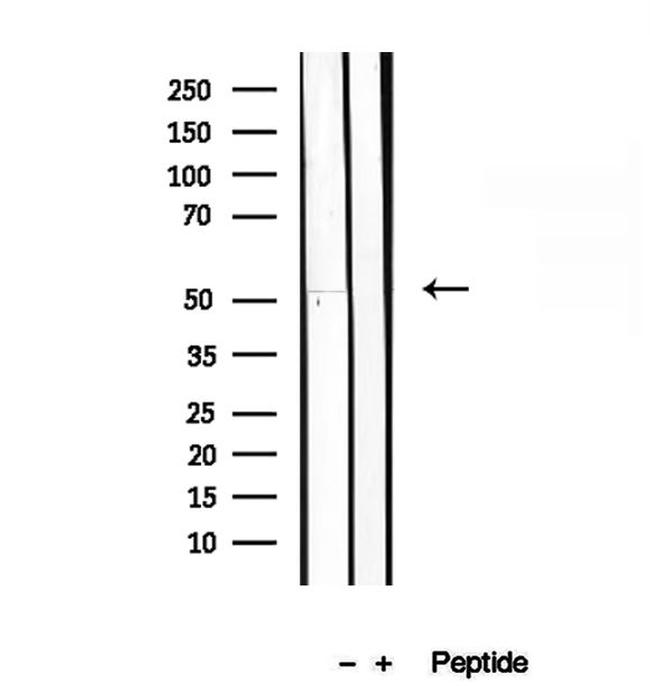 GSDMD Antibody in Western Blot (WB)