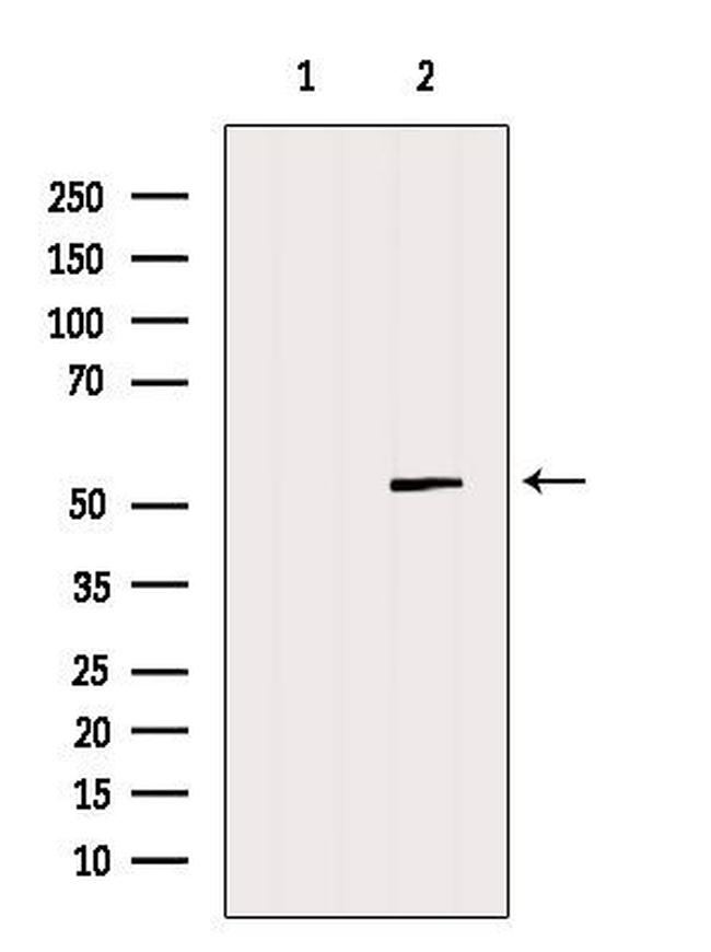 GSDMD Antibody in Western Blot (WB)