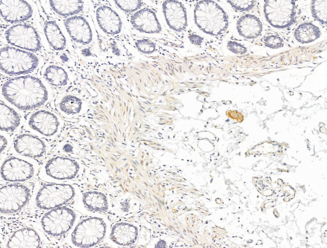 Phospho-PPAR gamma (Ser112) Antibody in Immunohistochemistry (Paraffin) (IHC (P))