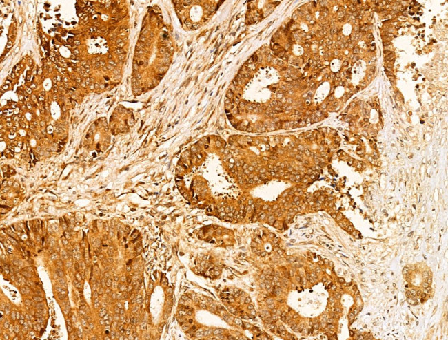 CASPASE 1 P10 (CLEAVED ALA317) Antibody in Immunohistochemistry (Paraffin) (IHC (P))