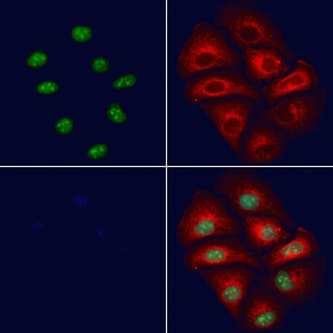 CASPASE 1 P10 (CLEAVED ALA317) Antibody in Immunocytochemistry (ICC/IF)