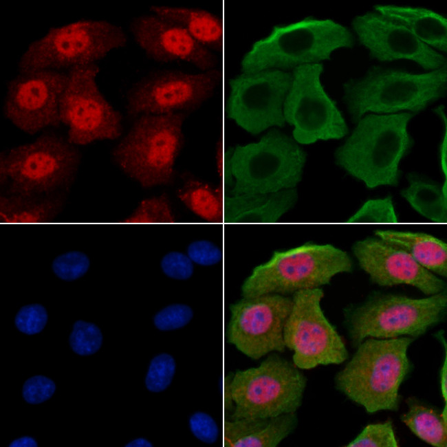 GABPB1 Antibody in Immunocytochemistry (ICC/IF)