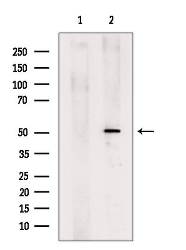 GSDMD Antibody in Western Blot (WB)