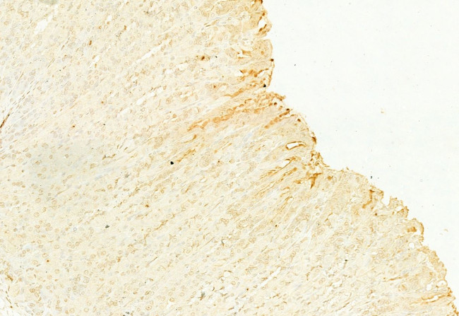 NQO1 Antibody in Immunohistochemistry (Paraffin) (IHC (P))