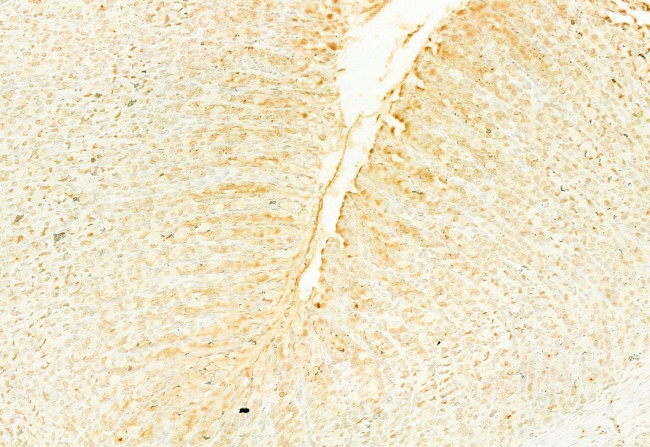 NQO1 Antibody in Immunohistochemistry (Paraffin) (IHC (P))