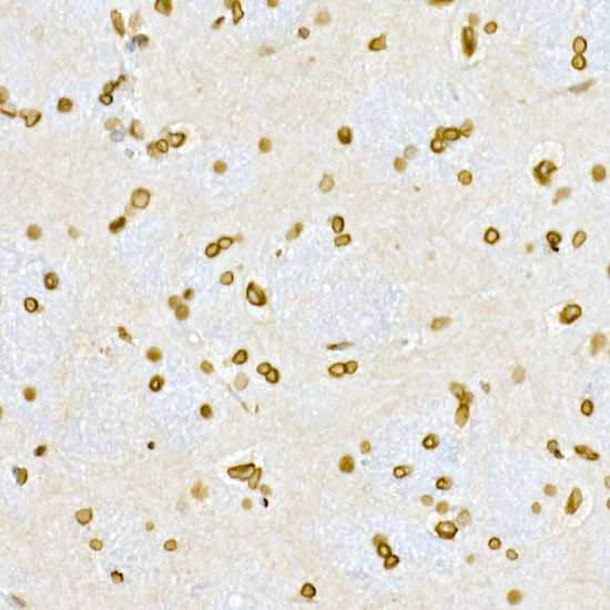 Lamin A/C Antibody in Immunohistochemistry (Paraffin) (IHC (P))