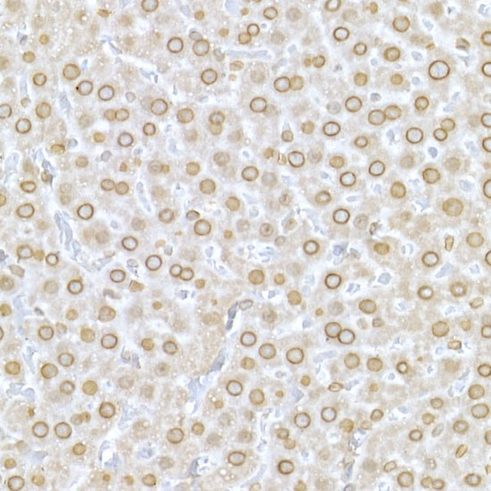 Lamin A/C Antibody in Immunohistochemistry (Paraffin) (IHC (P))