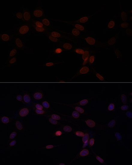 Lamin A/C Antibody in Immunocytochemistry (ICC/IF)